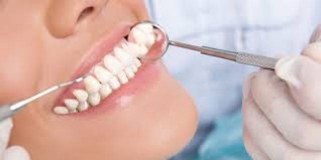 Tratament parodontal